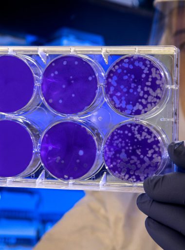 Degrading lysosomal membrane proteins