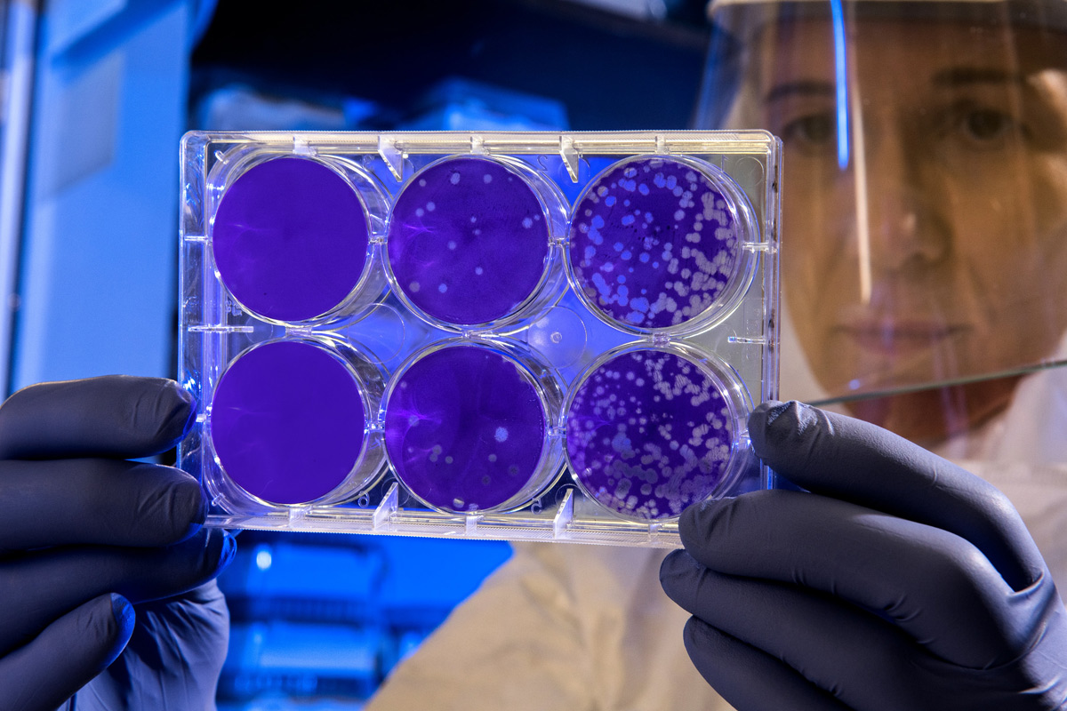 Degrading lysosomal membrane proteins